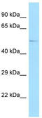 GA Binding Protein Transcription Factor Subunit Alpha antibody, TA329214, Origene, Western Blot image 