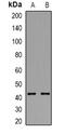 Actin Alpha Cardiac Muscle 1 antibody, orb382553, Biorbyt, Western Blot image 