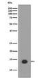 Histone Cluster 1 H2A Family Member E antibody, P16777-1, Boster Biological Technology, Western Blot image 