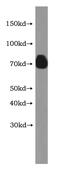 Hemopexin antibody, MBS2516691, MyBioSource, Western Blot image 