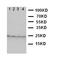 Fibroblast Growth Factor 22 antibody, LS-C312613, Lifespan Biosciences, Western Blot image 