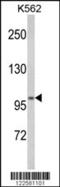 ATPase H+/K+ Transporting Non-Gastric Alpha2 Subunit antibody, 63-588, ProSci, Western Blot image 