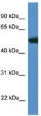 Tigger Transposable Element Derived 4 antibody, TA338806, Origene, Western Blot image 