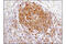 Spleen Associated Tyrosine Kinase antibody, 13198T, Cell Signaling Technology, Immunohistochemistry paraffin image 