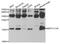 Microtubule Associated Protein 1 Light Chain 3 Alpha antibody, A5618, ABclonal Technology, Western Blot image 