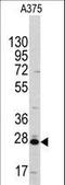 Chloride Intracellular Channel 1 antibody, LS-C100223, Lifespan Biosciences, Western Blot image 