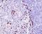 CD9 Molecule antibody, M01202, Boster Biological Technology, Immunohistochemistry paraffin image 