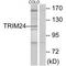 Tripartite Motif Containing 24 antibody, A03258-1, Boster Biological Technology, Western Blot image 
