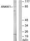 Ankyrin repeat and protein kinase domain-containing protein 1 antibody, GTX87164, GeneTex, Western Blot image 