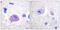 Hepatocyte Growth Factor-Regulated Tyrosine Kinase Substrate antibody, LS-C117954, Lifespan Biosciences, Immunohistochemistry paraffin image 