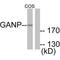 Minichromosome Maintenance Complex Component 3 Associated Protein antibody, PA5-49740, Invitrogen Antibodies, Western Blot image 