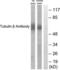 Tubulin Beta 3 Class III antibody, abx013240, Abbexa, Western Blot image 