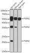 Presenilin 2 antibody, GTX55758, GeneTex, Western Blot image 