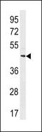 MAS Related GPR Family Member X4 antibody, LS-C203872, Lifespan Biosciences, Western Blot image 