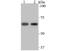 Nuclear RNA Export Factor 1 antibody, A02137-1, Boster Biological Technology, Western Blot image 