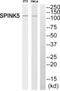 Serine Peptidase Inhibitor, Kazal Type 5 antibody, PA5-39437, Invitrogen Antibodies, Western Blot image 