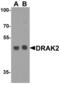 Serine/Threonine Kinase 17b antibody, GTX28419, GeneTex, Western Blot image 