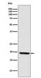 LIM Domain Only 2 antibody, M03502, Boster Biological Technology, Western Blot image 