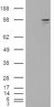 Neuroligin 3 antibody, EB08221, Everest Biotech, Western Blot image 