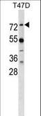 MX Dynamin Like GTPase 1 antibody, LS-C164690, Lifespan Biosciences, Western Blot image 