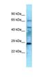 EYA Transcriptional Coactivator And Phosphatase 4 antibody, orb330089, Biorbyt, Western Blot image 