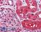 Radixin antibody, LS-B4336, Lifespan Biosciences, Immunohistochemistry paraffin image 