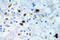 Cyclin Dependent Kinase 1 antibody, LS-C178124, Lifespan Biosciences, Immunohistochemistry paraffin image 
