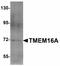 Anoctamin 1 antibody, LS-C108600, Lifespan Biosciences, Western Blot image 