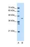 Mitochondrial Carrier 1 antibody, NBP1-69285, Novus Biologicals, Western Blot image 