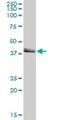 Activating Signal Cointegrator 1 Complex Subunit 1 antibody, H00051008-B01P, Novus Biologicals, Western Blot image 