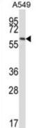 Frizzled Class Receptor 5 antibody, abx027881, Abbexa, Western Blot image 