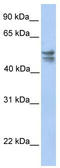 TRNA 5-Methylaminomethyl-2-Thiouridylate Methyltransferase antibody, TA346792, Origene, Western Blot image 