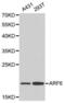 ARF6-Specific antibody, LS-C192313, Lifespan Biosciences, Western Blot image 