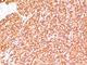CD45RB antibody, NBP2-44859, Novus Biologicals, Immunohistochemistry frozen image 