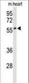 Sestrin 1 antibody, LS-C168998, Lifespan Biosciences, Western Blot image 