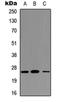 Triggering Receptor Expressed On Myeloid Cells 1 antibody, orb234802, Biorbyt, Western Blot image 