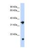 Glycerol-3-Phosphate Dehydrogenase 1 antibody, NBP1-55332, Novus Biologicals, Western Blot image 