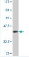 CBFA2/RUNX1 Partner Transcriptional Co-Repressor 2 antibody, H00009139-M07, Novus Biologicals, Western Blot image 