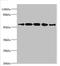 VPS33B Interacting Protein, Apical-Basolateral Polarity Regulator, Spe-39 Homolog antibody, orb357523, Biorbyt, Western Blot image 