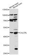 Calcitonin Receptor Like Receptor antibody, LS-C747211, Lifespan Biosciences, Western Blot image 