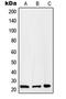 RAB2B, Member RAS Oncogene Family antibody, LS-C353595, Lifespan Biosciences, Western Blot image 