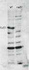 RAD51 Recombinase antibody, 62-101, BioAcademia Inc, Western Blot image 