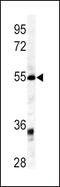 Growth/differentiation factor 6 antibody, MBS9206436, MyBioSource, Western Blot image 