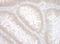 Tyrosyl-DNA Phosphodiesterase 2 antibody, A302-737A, Bethyl Labs, Immunohistochemistry paraffin image 