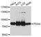 Protein Disulfide Isomerase Family A Member 4 antibody, STJ24943, St John