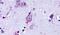Lysophosphatidic Acid Receptor 3 antibody, PA5-33497, Invitrogen Antibodies, Immunohistochemistry frozen image 