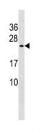 CutA Divalent Cation Tolerance Homolog antibody, abx034722, Abbexa, Western Blot image 