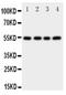 Cystatin A antibody, PA5-79080, Invitrogen Antibodies, Western Blot image 