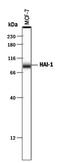 Serine Peptidase Inhibitor, Kunitz Type 1 antibody, PA5-47053, Invitrogen Antibodies, Western Blot image 