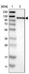 RNA Binding Motif Protein 5 antibody, PA5-53586, Invitrogen Antibodies, Western Blot image 
